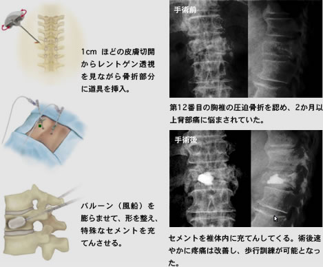 専門外来 受診される方へ 北里大学医学部 整形外科学